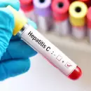 Ya hay más de 420 casos de hepatitis aguda en niños y niñas en todo el mundo