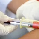 SALUD - Desarrollan una sangre falsa para luchar contra los mosquitos y la malaria