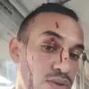VIDEO: Un conductor le rompi a trompadas el vidrio a un colectivo e hiri al chofer