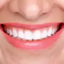 El alimento con m�s hierro y col�geno que elimina el sarro y ayuda a blanquear la dentadura