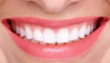dientes blancos