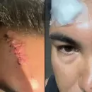 El fuerte descargo de un hincha del Tomba, tras los disturbios con la polic�a: "Termin� en urgencias"