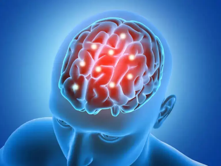 cerebro