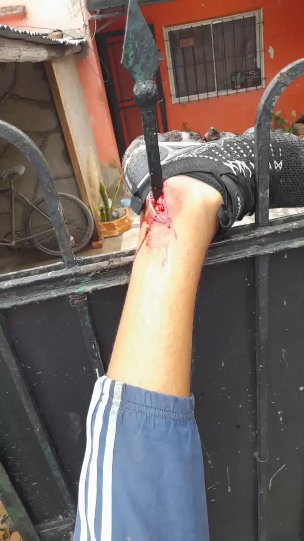 Así encontraron al ladrón cuando las autoridades llegaron al lugar.
