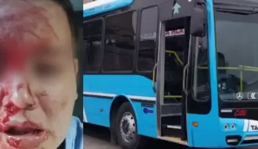 insolito ataque