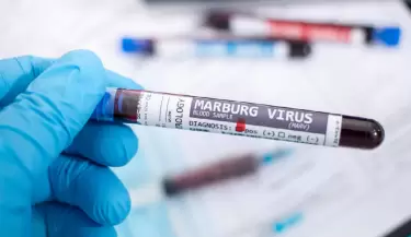 virus de marburgo