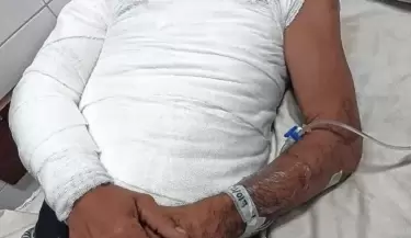 cuerpo quemado de hombre en Santa Fe