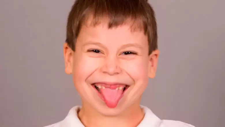 angelman