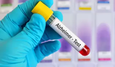 Alzheimer