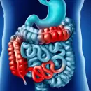 El impacto silencioso de las enfermedades intestinales en la población joven