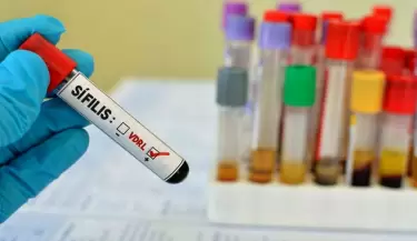 sifilis