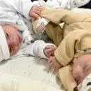 Recibieron el alta los bebes gemelos que fueron operados dentro del �tero