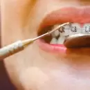 Anmat prohibi� brackets falsificados y un equipo de depilaci�n l�ser en todo el pa�s