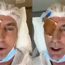 Marley pas� por el quir�fano y qued� 0km de su vista: "Adi�s a los anteojos"