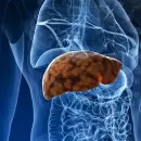 Nutrientes clave m�s all� del magnesio para combatir el h�gado graso