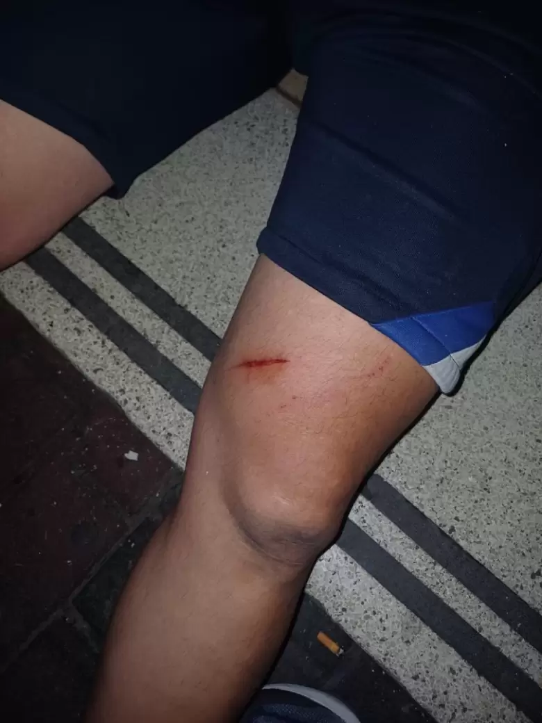 polic�a herido-marcha antiminera