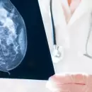 Inteligencia artificial y salud: avances en la detecci�n temprana del c�ncer de mama