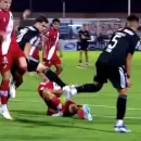 (Video) Sensible baja en Deportivo Maip�: confirmaron la grave lesi�n de Juan Cruz Arno