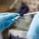 Cuánto cuesta el test del virus del papiloma humano y quiénes pueden acceder de forma gratuita en Mendoza